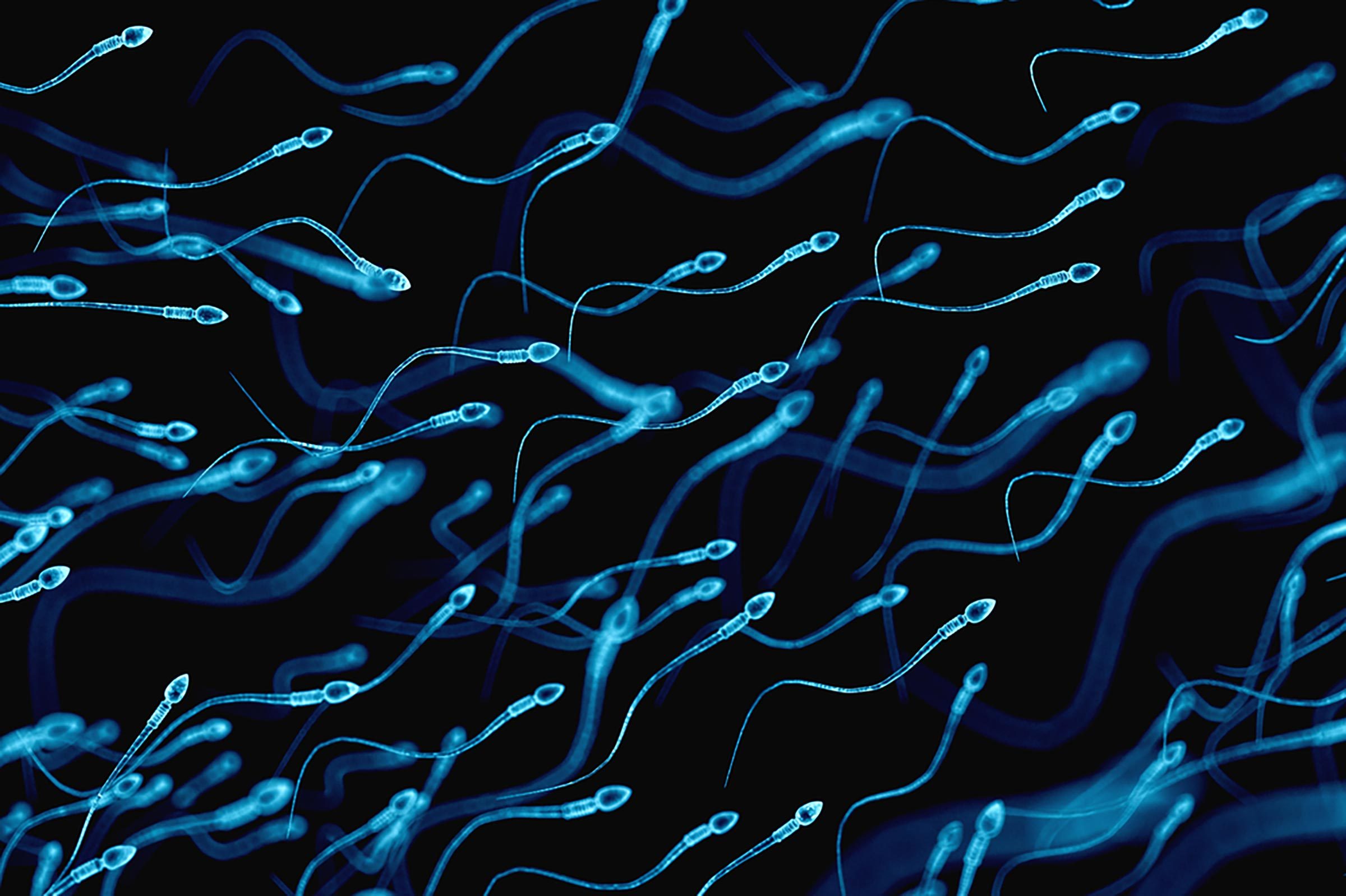 sperm