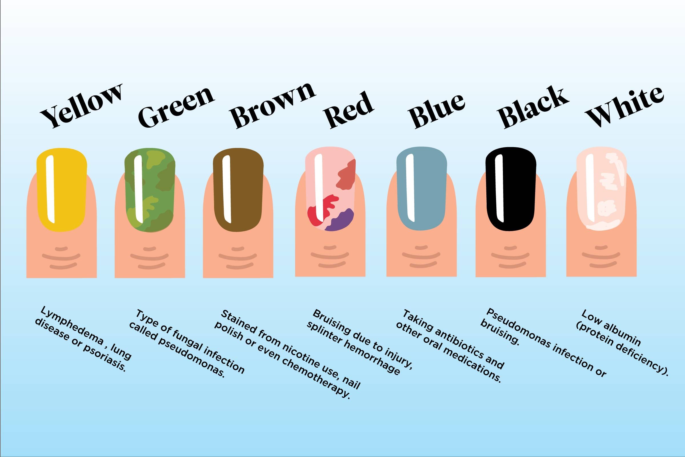 What-the-Color-of-Your-Nails-Says-About-Your-Health