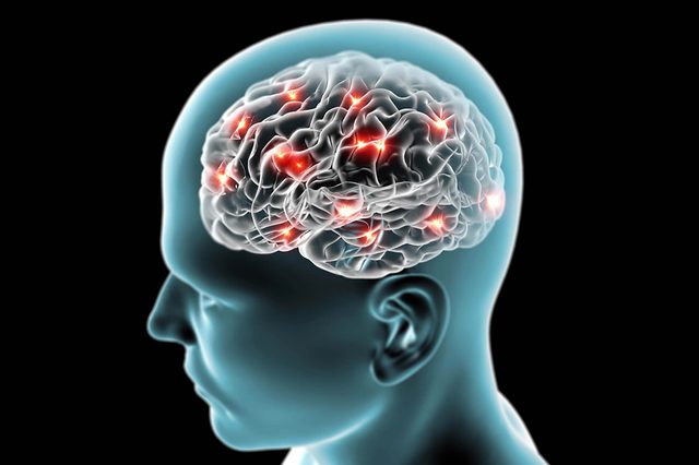 brain