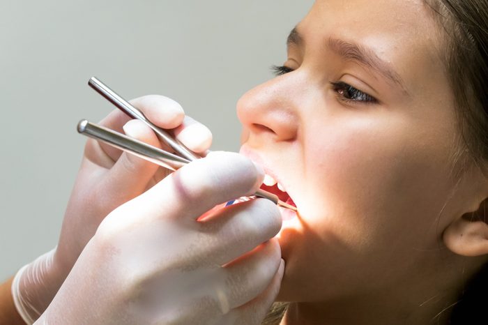 Closeup of teenage girl sitting in dentist chair and opens mouth