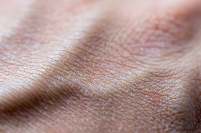 Human skin pattern dry, convex from the veins, Close up macro detail