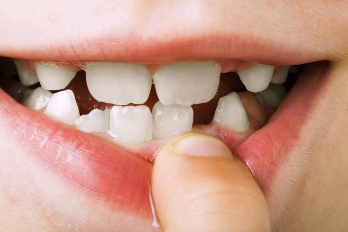 Child shows tooth. Close up studio shot.