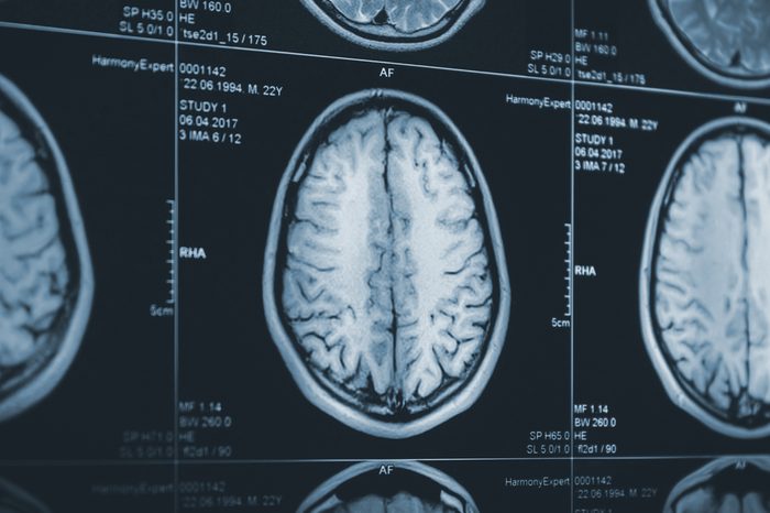 Close up of a brain CT scan. X-ray medicine research