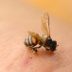 This Is the Most Painful Place to Get Stung by a Bee