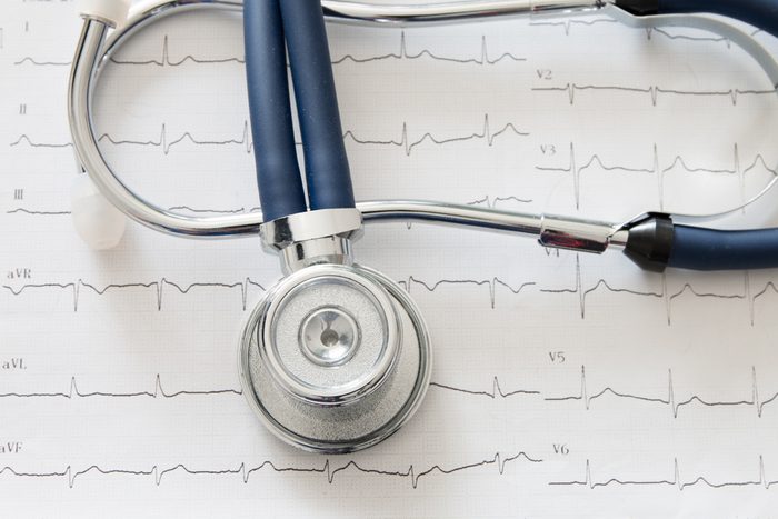 Stethoscope on electrocardiogram chart
