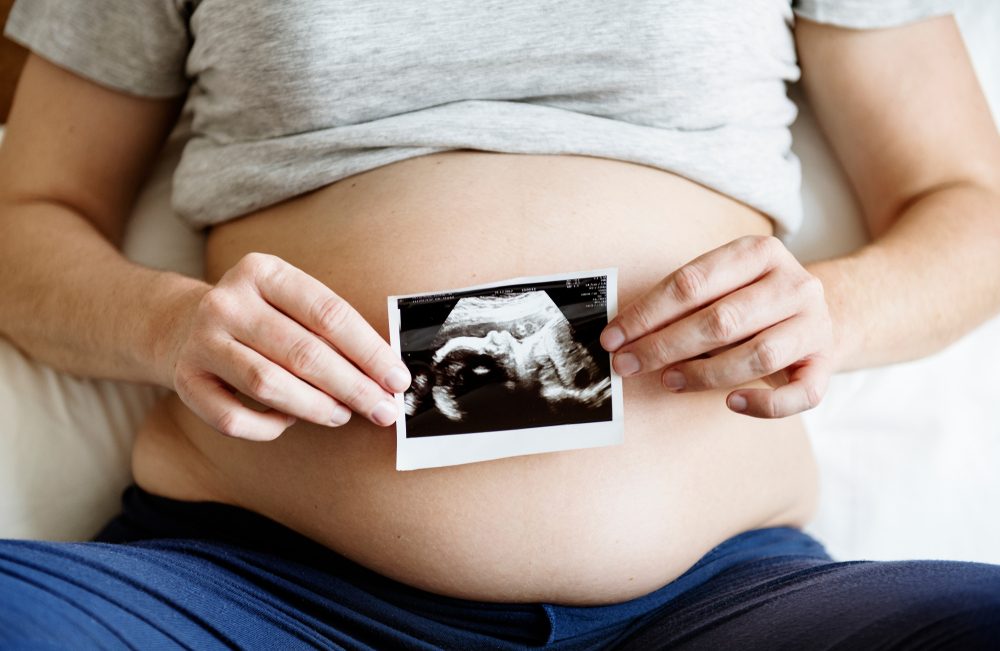 Pregnant woman showing fetus ultrasound photo