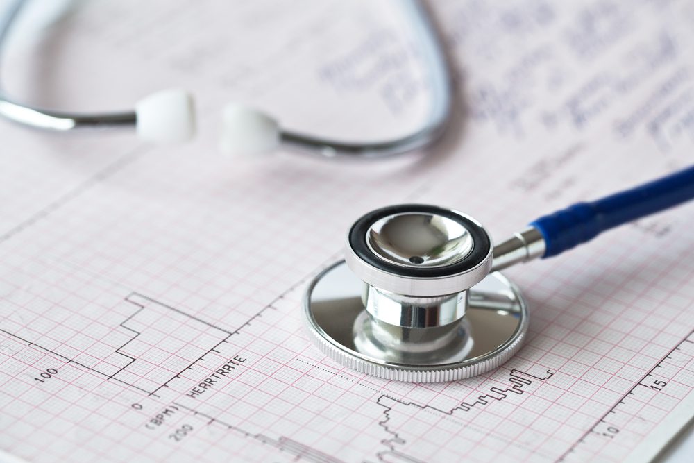 Stock image of stethoscope put on an electrocardiogram sheet. This medical objects are shooted after basic cardiology exams. 