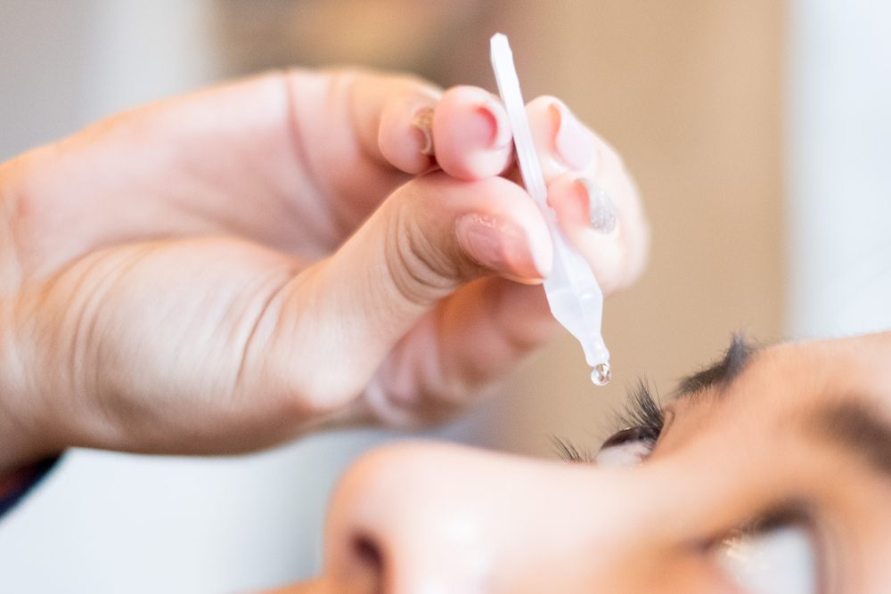 Closeup view of young woman applying eye drop, artificial tears.