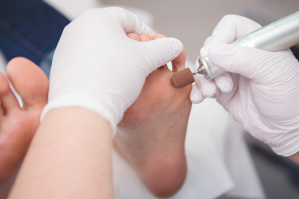 podiatrist ( chiropodist ) cleaning womans feet ( toenails )