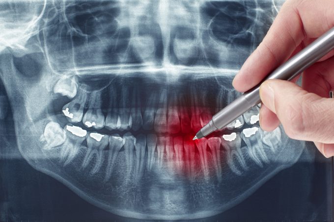 dental x-ray