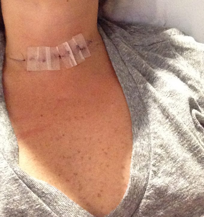 Christine coppa scar