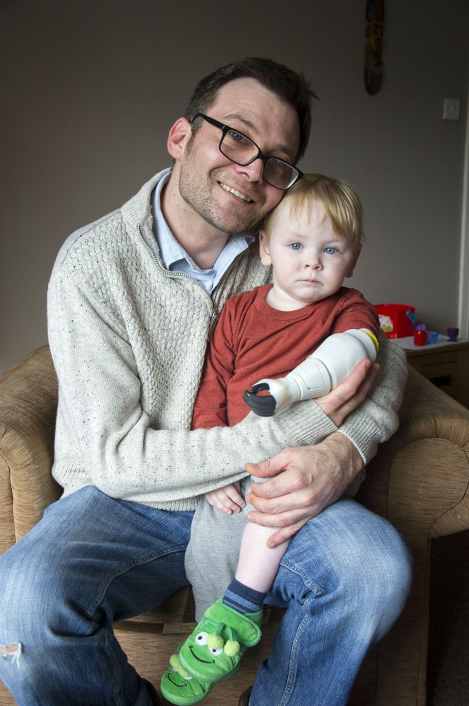 Father creates bionic prosthetic arm for baby son, Anglesey, Wales, UK - 01 Mar 2017