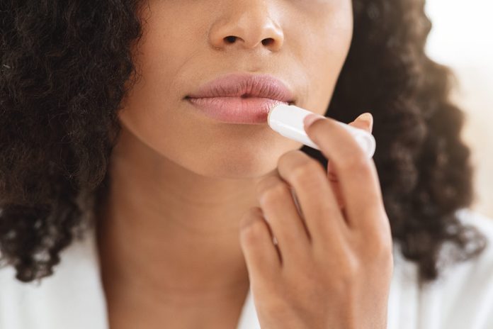 Chapped Lips Remedies. Closeup Of Black Woman Applying Chapstick Moisturizing Lip Balm