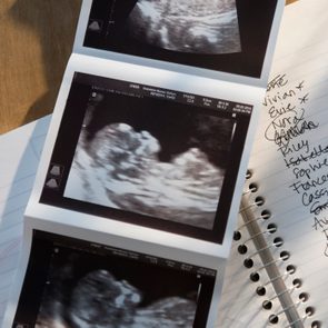 Ultrasound picture of baby with list of names