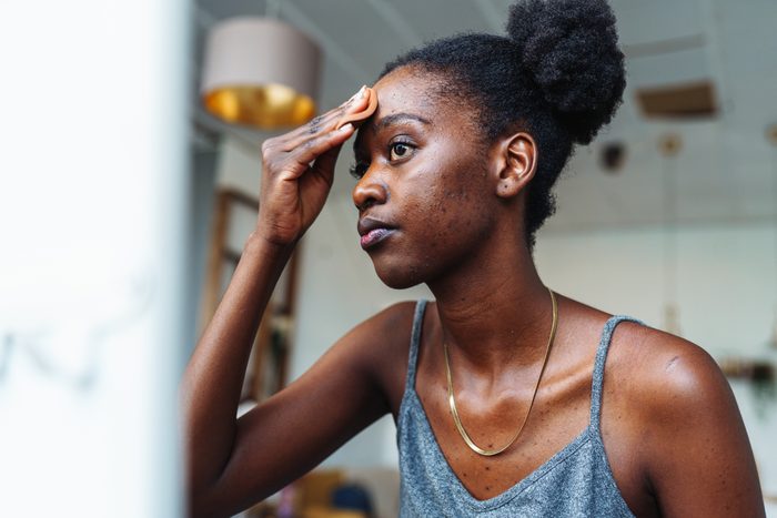 Skin problems. acne. Woman applying concealer on her face to hide pimples