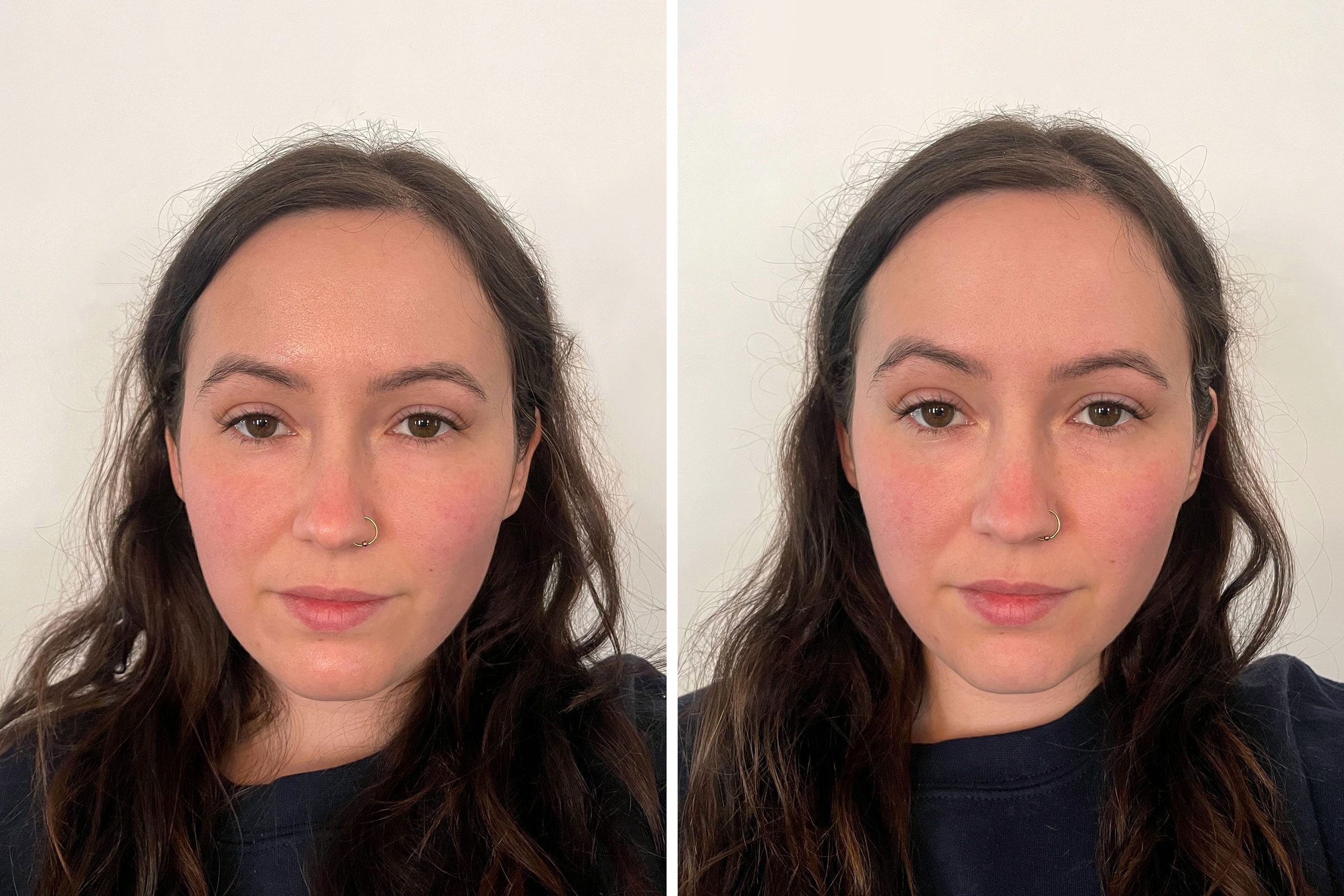 Revlon face roller Before And After