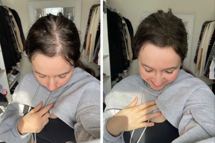 toppik fibers hair spray before and after