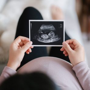 Young Asian pregnant woman lying on sofa at home, looking at the ultrasound scan photo of her baby