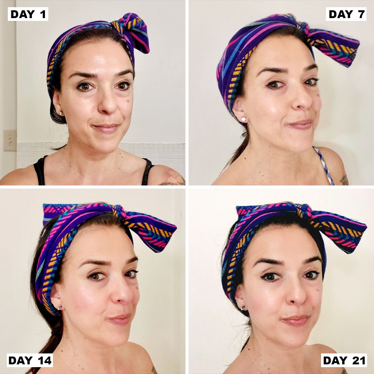 Solawave 4 In 1 Radiant Renewal Skincare Wand Day 1-21 Results