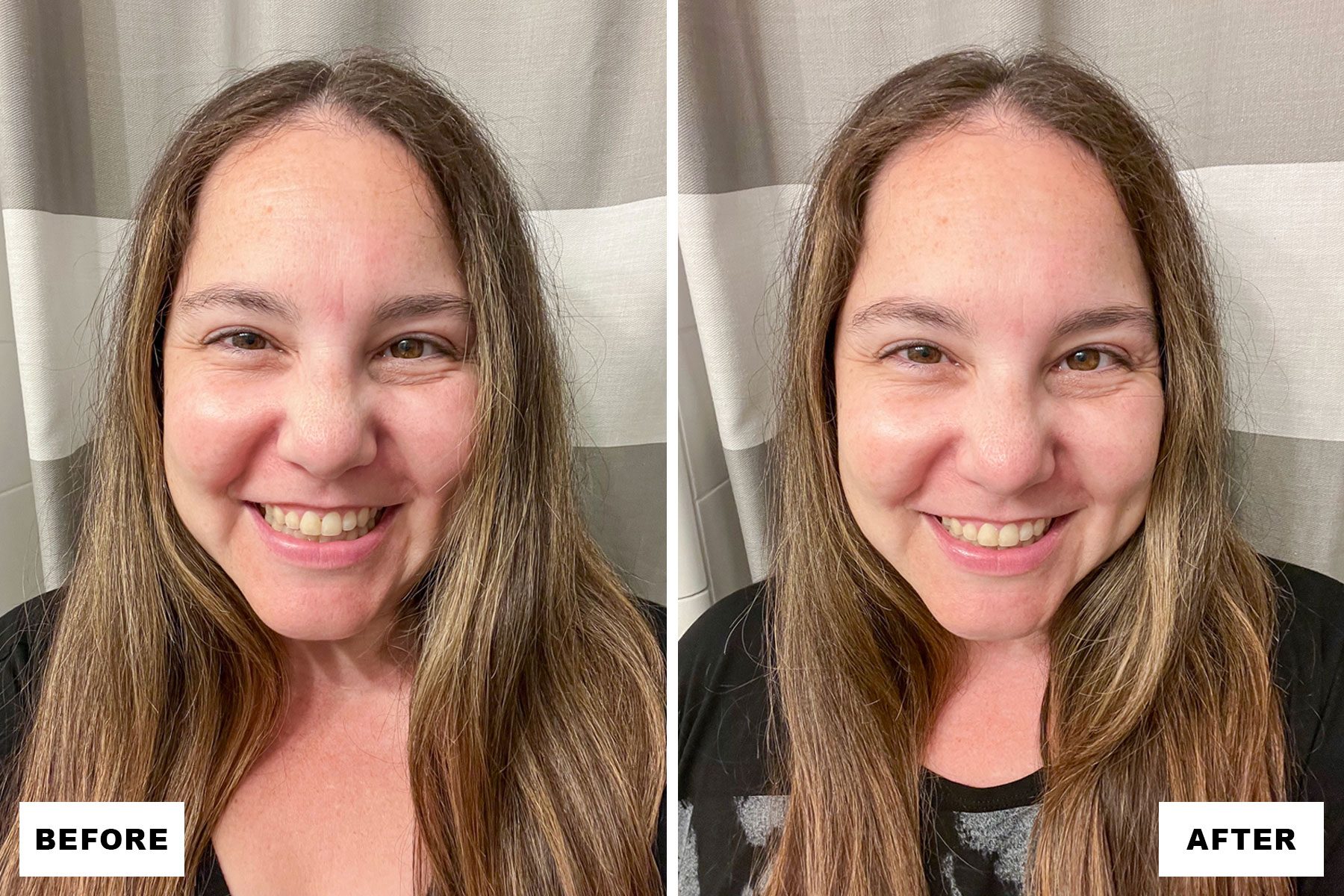 Sio Beauty Wrinkle Patches Before and After Results