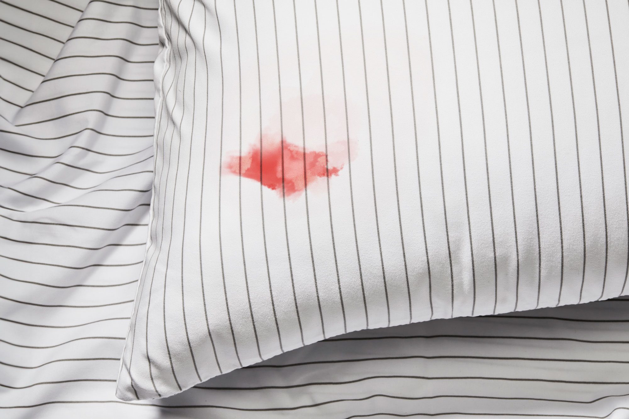 How to Get Blood Out of Sheets in 3 Simple Steps