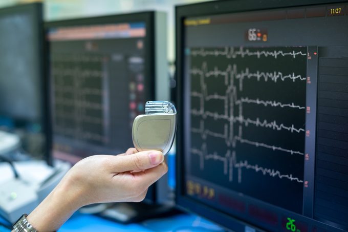 Doctor hand holds Pacemaker device with screen of EKG monitoring background